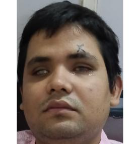 patient Image
